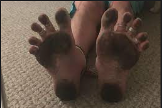 dirty soles of feet